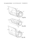 CONFIGURABLE INFLATABLE SUPPORT DEVICES diagram and image