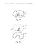 CONFIGURABLE INFLATABLE SUPPORT DEVICES diagram and image