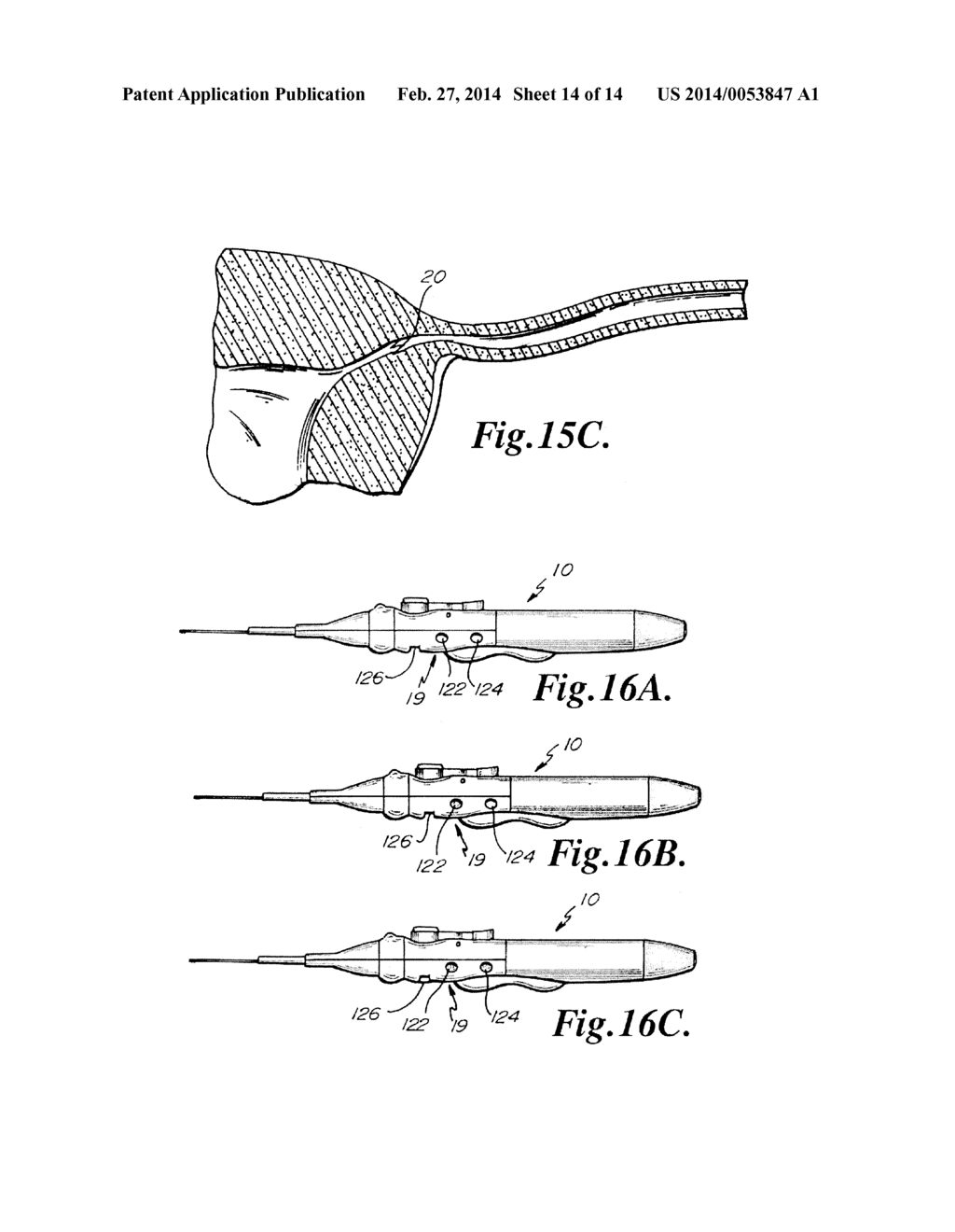 LINEAR MOTION DELIVERY SYSTEM FOR FEMALE STERILIZATION DEVICE - diagram, schematic, and image 15