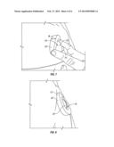 PROTECTIVE DEVICE FOR IMPLANTED MEDICAL DEVICE diagram and image