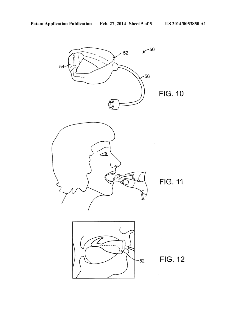 METHOD AND SYSTEM FOR SIZING AN ORAL DEVICE - diagram, schematic, and image 06