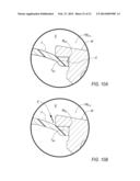 Bead Seater Apparatus and Method for Using the Same diagram and image