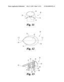 UPRIGHT SQUEEZE FOAMER diagram and image