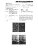 BINOCULAR VISUAL EXPERIENCE ENRICHMENT SYSTEM diagram and image