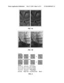 BINOCULAR VISUAL EXPERIENCE ENRICHMENT SYSTEM diagram and image