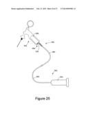 ENDOSCOPIC CALIBRATION METHOD AND APPARATUS diagram and image