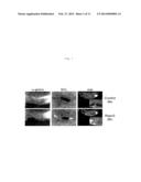 RSPONDINS AS MODULATORS OF ANGIOGENESIS AND VASCULOGENESIS diagram and image