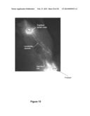 METHODS AND  COMPOSITIONS FOR TREATING INFLAMMATORY CONDITIONS diagram and image