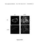 METHODS AND  COMPOSITIONS FOR TREATING INFLAMMATORY CONDITIONS diagram and image