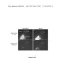 METHODS AND  COMPOSITIONS FOR TREATING INFLAMMATORY CONDITIONS diagram and image