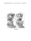 METHODS AND  COMPOSITIONS FOR TREATING INFLAMMATORY CONDITIONS diagram and image