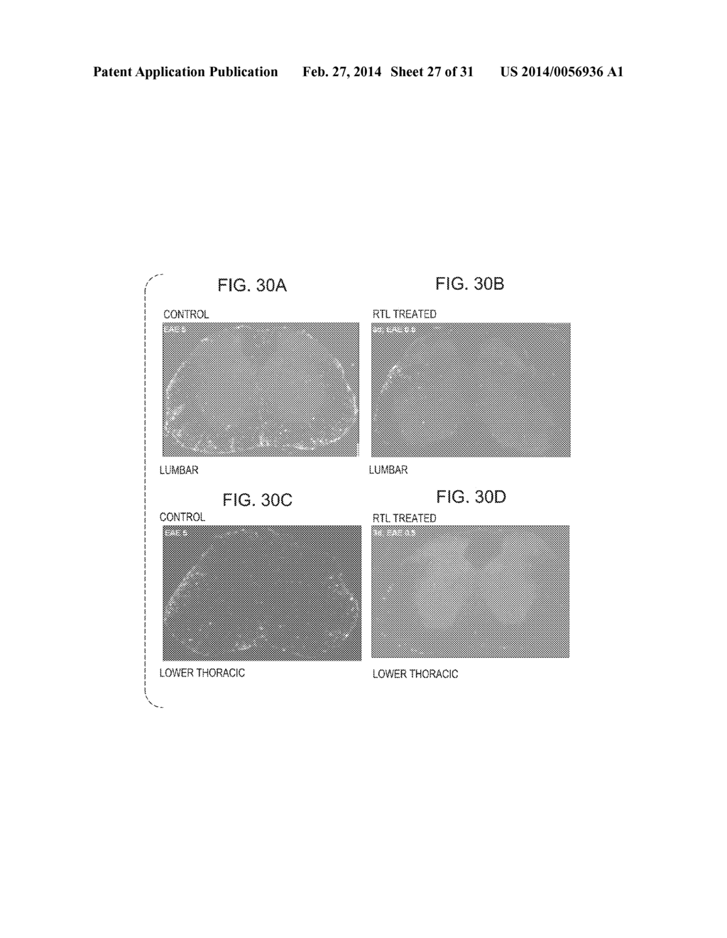 COMPOSITIONS AND METHODS USING RECOMBINANT MHC MOLECULES FOR THE TREATMENT     OF STROKE - diagram, schematic, and image 28