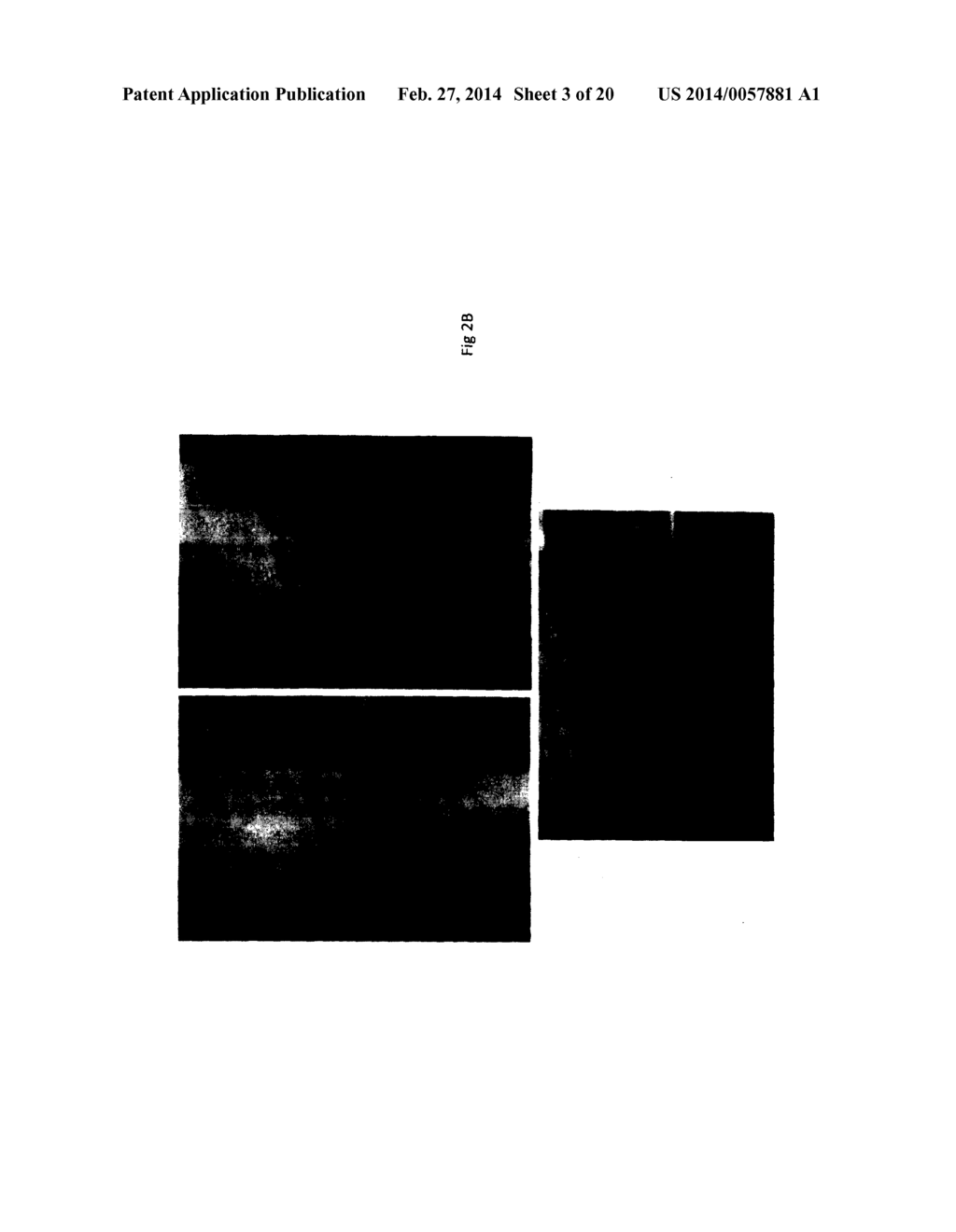 Composition for the Treatment of Skin Conditions - diagram, schematic, and image 04