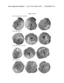 Induction of Arteriogenesis diagram and image