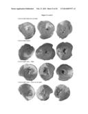 Induction of Arteriogenesis diagram and image