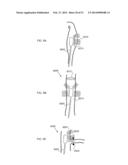 ENERGETIC MODULATION OF NERVES diagram and image