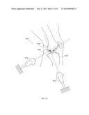 ENERGETIC MODULATION OF NERVES diagram and image