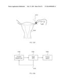 ENERGETIC MODULATION OF NERVES diagram and image