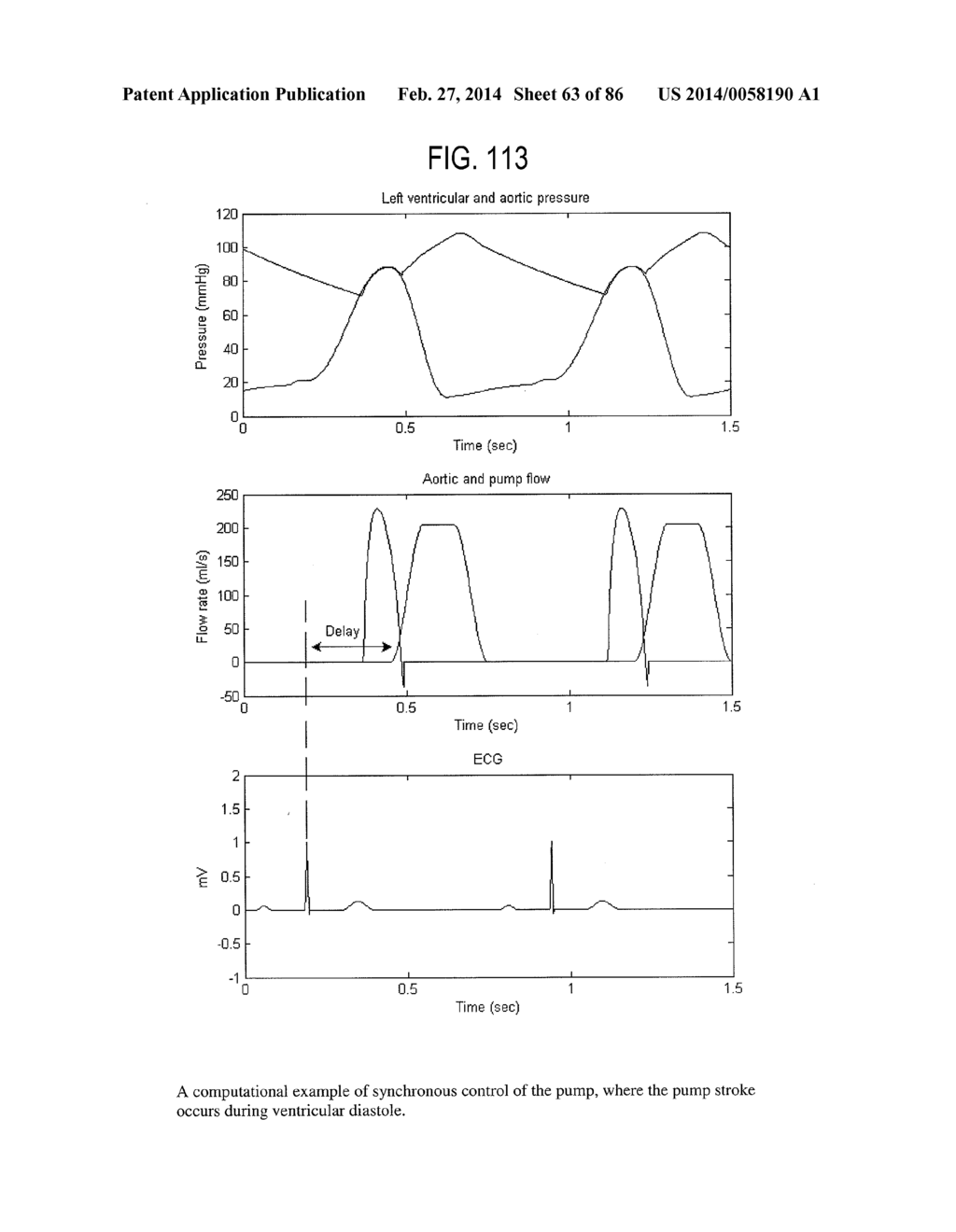 SYSTEM AND METHOD FOR CONTROLLING PUMP - diagram, schematic, and image 64