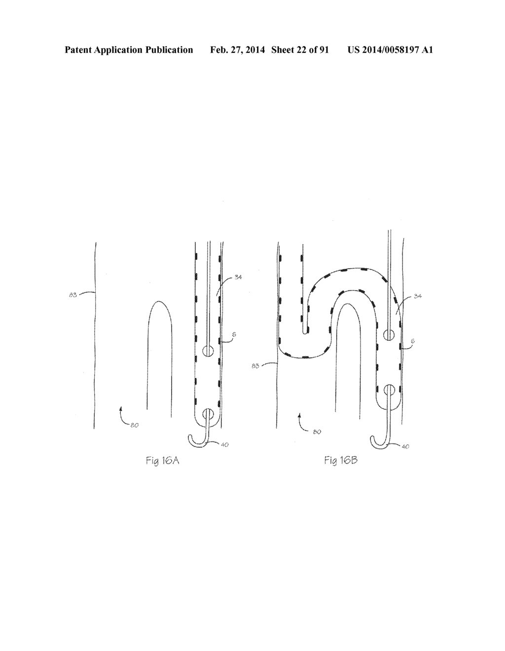 Low Profile Electrode Assembly - diagram, schematic, and image 23