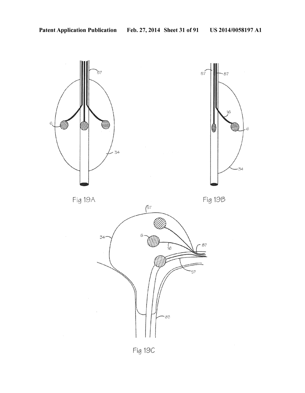 Low Profile Electrode Assembly - diagram, schematic, and image 32