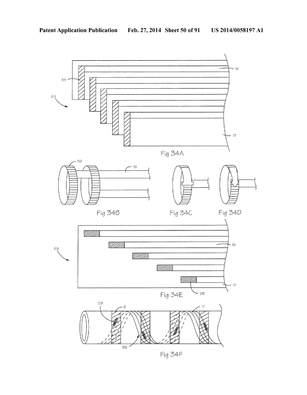 Low Profile Electrode Assembly - diagram, schematic, and image 51