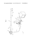 ENDOSCOPE diagram and image