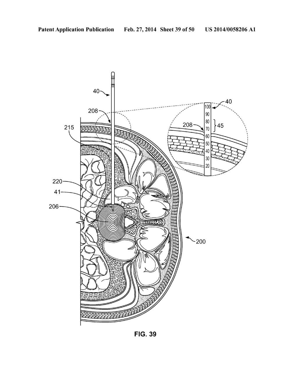 Surgical Access System and Related Methods - diagram, schematic, and image 40