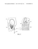 DEVICE FOR RECORDING ULTRASOUND-INDUCED FETAL EEG, AND METHOD OF USE diagram and image