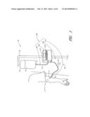 FLUID HANDLING CASSETTE diagram and image