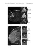 METHOD AND APPARATUS USING MAGNETIC RESONANCE IMAGING FOR CANCER     IDENTIFICATION diagram and image