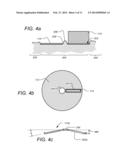 BREAST ULTRASOUND SCANNING DEVICE diagram and image