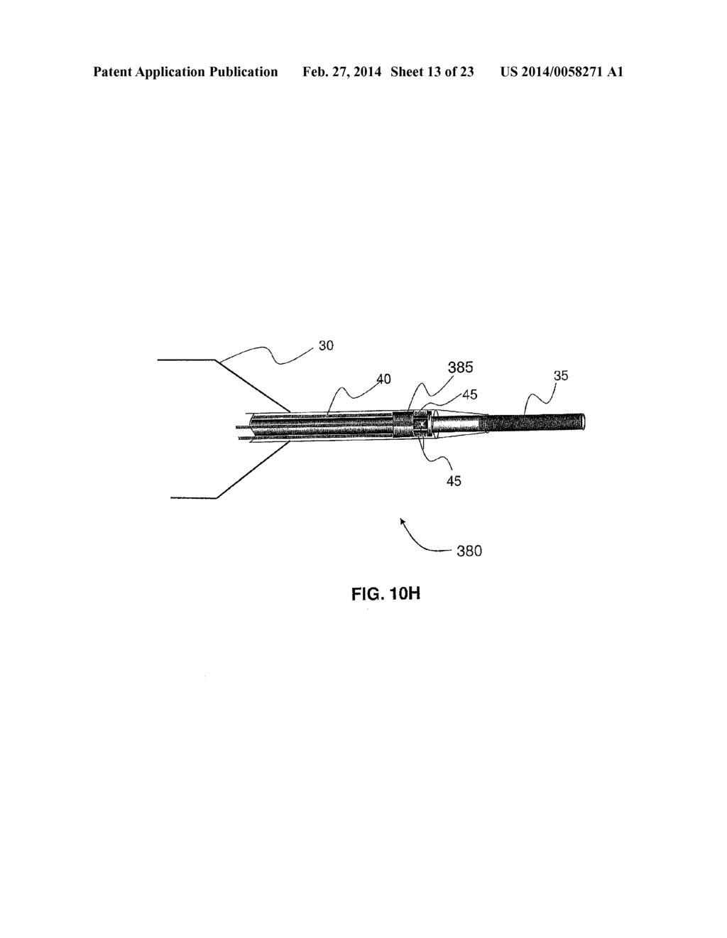 SYSTEMS AND METHODS FOR ANALYSIS AND TREATMENT OF A BODY LUMEN - diagram, schematic, and image 14