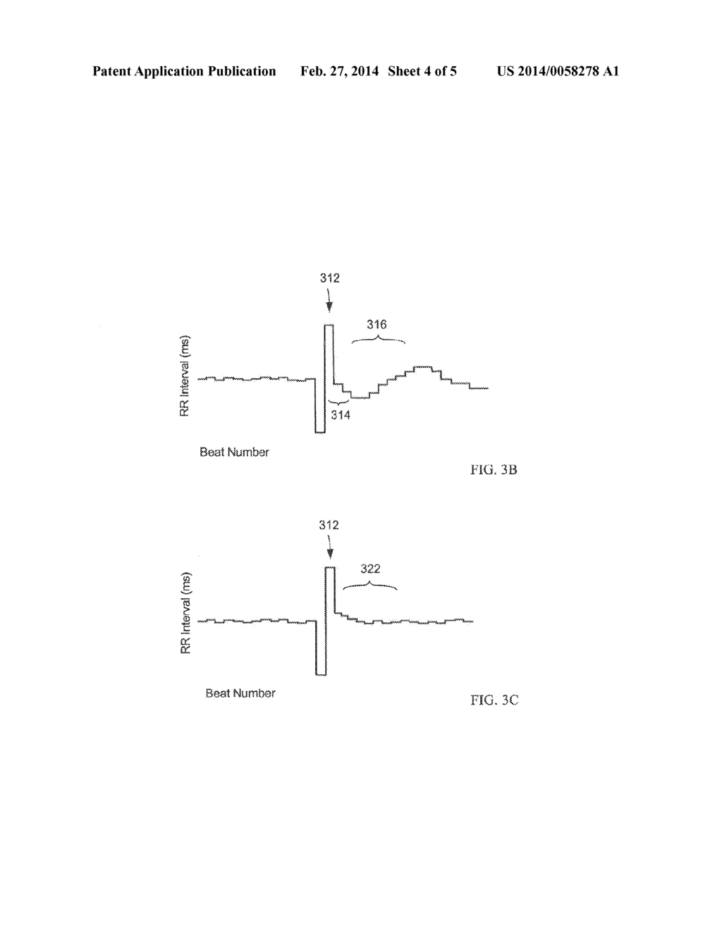 SYSTEMS AND METHODS FOR DETECTING ISCHEMIC EVENTS - diagram, schematic, and image 05