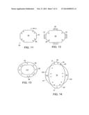 IMPLANTABLE MEDICAL DEVICE FOR IMPROVED PLACEMENT IN THE BODY diagram and image