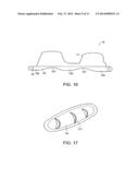 IMPLANTABLE MEDICAL DEVICE FOR IMPROVED PLACEMENT IN THE BODY diagram and image