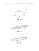 IMPLANTABLE MEDICAL DEVICE FOR IMPROVED PLACEMENT IN THE BODY diagram and image