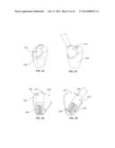 MEDICATED MODULE WITH AUTOMATIC RESERVOIR ENGAGEMENT AND LOCK MECHANISM diagram and image