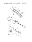 EXTENDABLE PLUNGER ROD FOR MEDICAL SYRINGE diagram and image