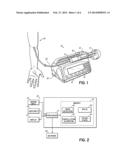 SYRINGE PUMP RAPID OCCLUSION DETECTION SYSTEM diagram and image