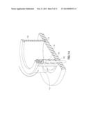 Subcutaneous Infusion Device diagram and image