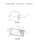 Subcutaneous Infusion Device diagram and image