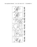 Subcutaneous Infusion Device diagram and image