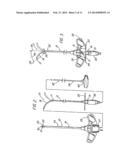 HOLLOW CURVED SUPERELASTIC MEDICAL NEEDLE AND METHOD diagram and image