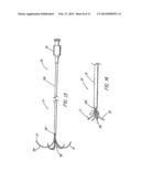 HOLLOW CURVED SUPERELASTIC MEDICAL NEEDLE AND METHOD diagram and image