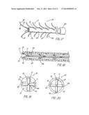 HOLLOW CURVED SUPERELASTIC MEDICAL NEEDLE AND METHOD diagram and image