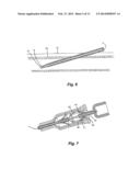 Apparatus for Peripheral Vascular Access diagram and image