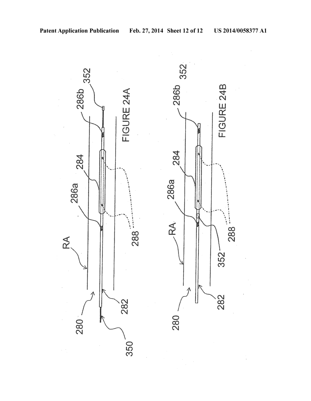 METHODS AND APPARATUS FOR RENAL NEUROMODULATION - diagram, schematic, and image 13