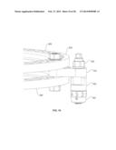 BONE TRANSPORT EXTERNAL FIXATION FRAME diagram and image