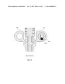 BONE TRANSPORT EXTERNAL FIXATION FRAME diagram and image